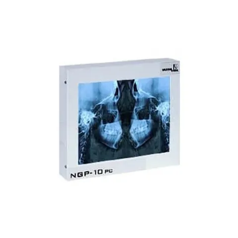 Negatoskop Cefalom 01