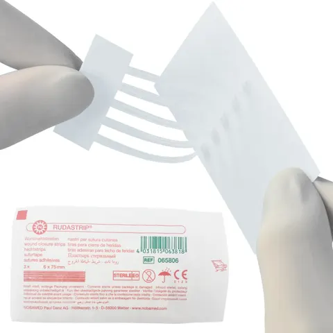 RUDASTRIP Paski do zamykania ran Nobamed 6 x 75mm - 1 BLISTER