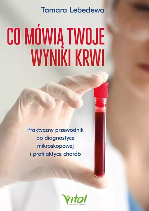 Co mówią twoje wyniki krwi - Tamara Lebedewa