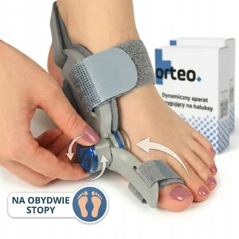 Aparat korygujący na haluksy Orteo SM315 - zestaw na 2 nogi