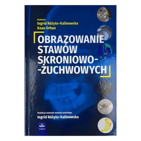 Obrazowanie stawów skroniowo-żuchwowych