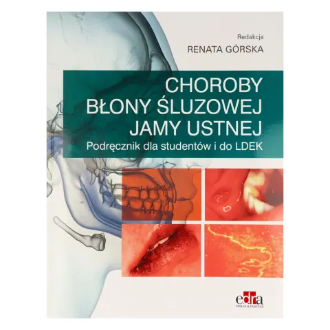 Edra Urban & Partner - Choroby błony śluzowej