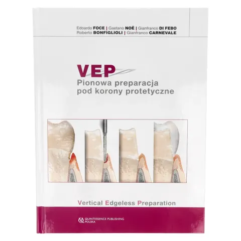 VEP Pionowa preparacja pod korony protetyczne