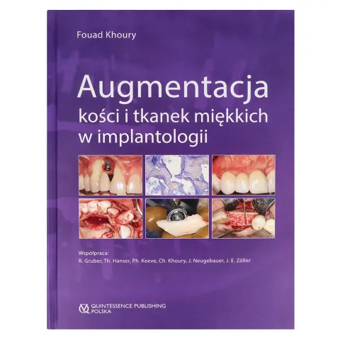Augmentacja kości i tkanek miękkich Quintessence