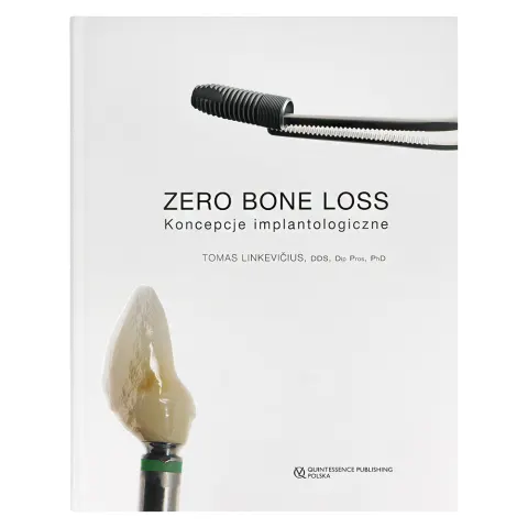 ZERO BONE LOSS Koncepcje implantologiczne Quintessence