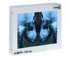 Negatoskop CEFALOM 01 - STOMATOLOGICZNY
